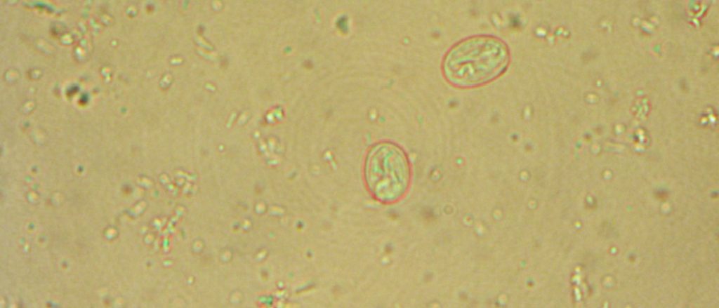 How Long Does Giardia Live on Fabric: Essential Facts Revealed